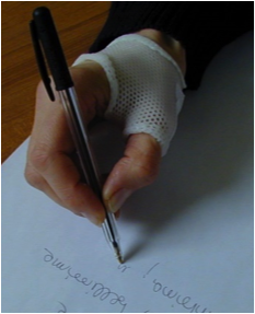 scrittura senza dolore per azione stabilizzatrice dell'ortesi sull'articolazione trapeziometacarpale